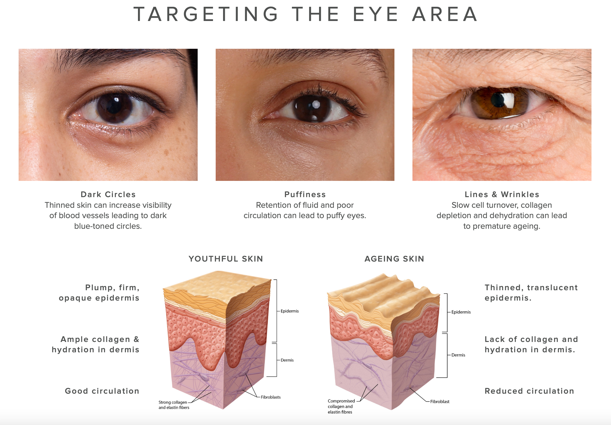 ageing eyes - what to look for and why ageing skin occurs indulgence beauty daventry, rugby, Warwickshire, northamptonshire